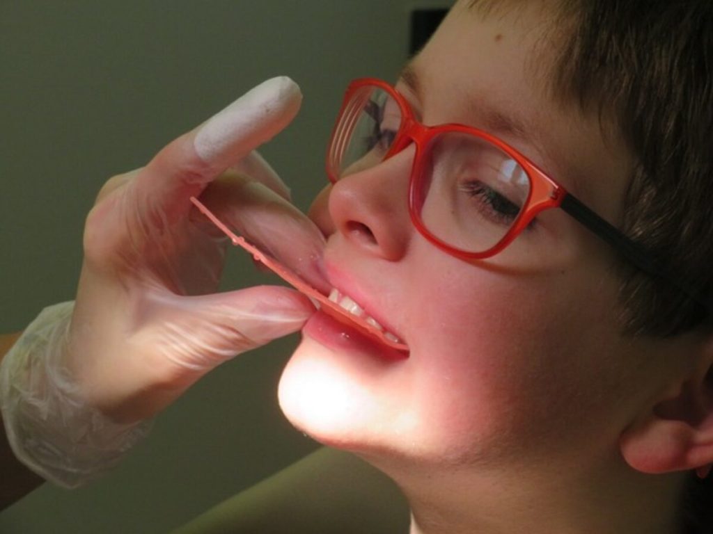 How Much Do Dental Implants