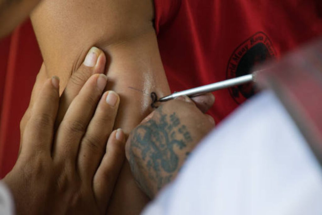 Laser Tattoo Removal Near Me in New York