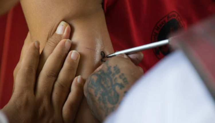 Laser Tattoo Removal Near Me in New York